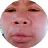 คุณลำเยาว์-ลมชัก-มึนเวียน-กินข้าวน้อย