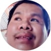 คุณวีระพล โรคลมชัก แบบเกร็งเหม่อ